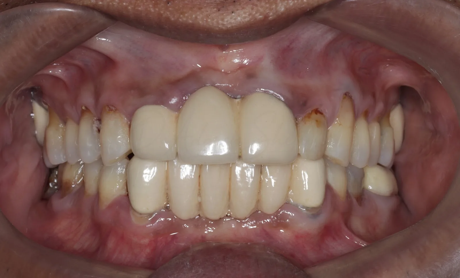 FMR Case 1 Before