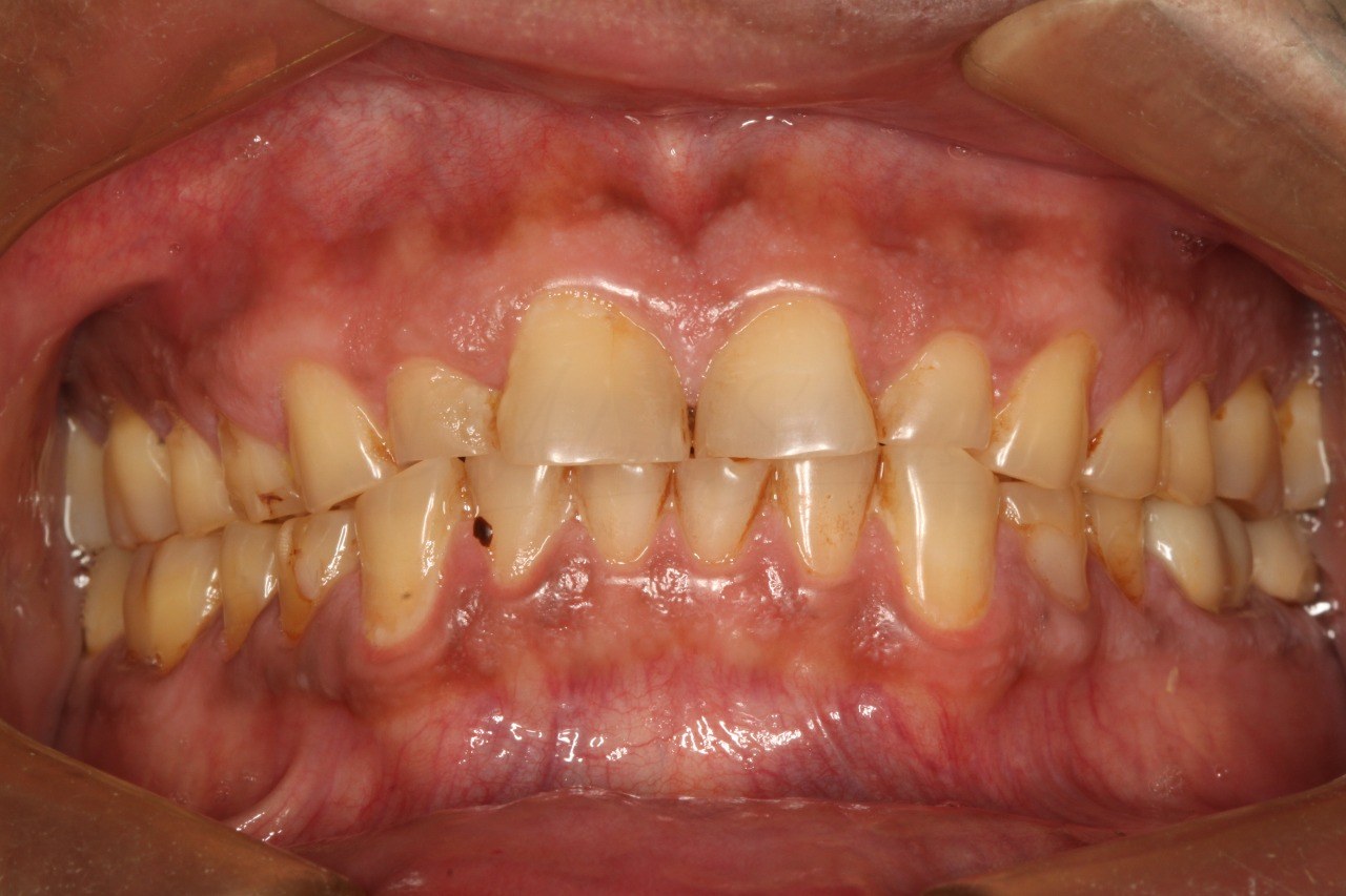 FMR Case 3 Before