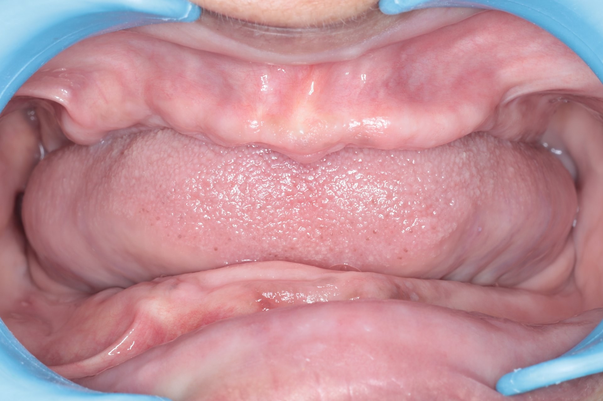 FMR Case 6 Before